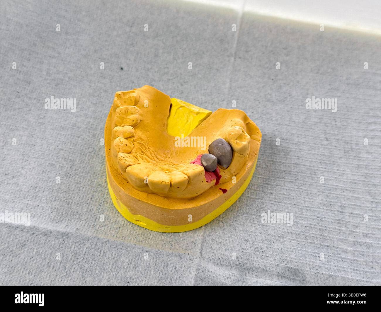 Dental model showing upper teeth with cavities during an educational demonstration Stock Photo