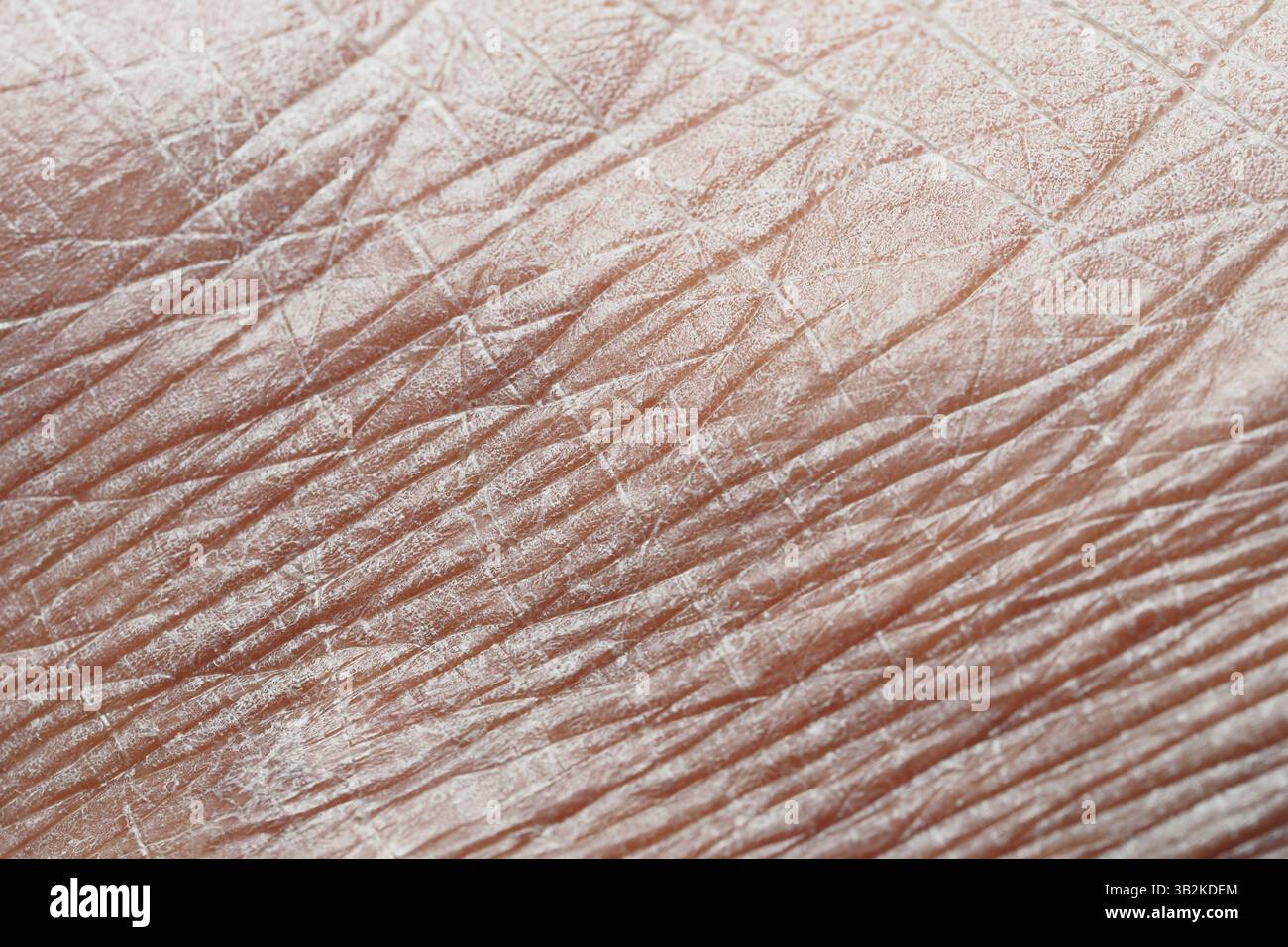 Skin characteristics hi-res stock photography and images - Alamy