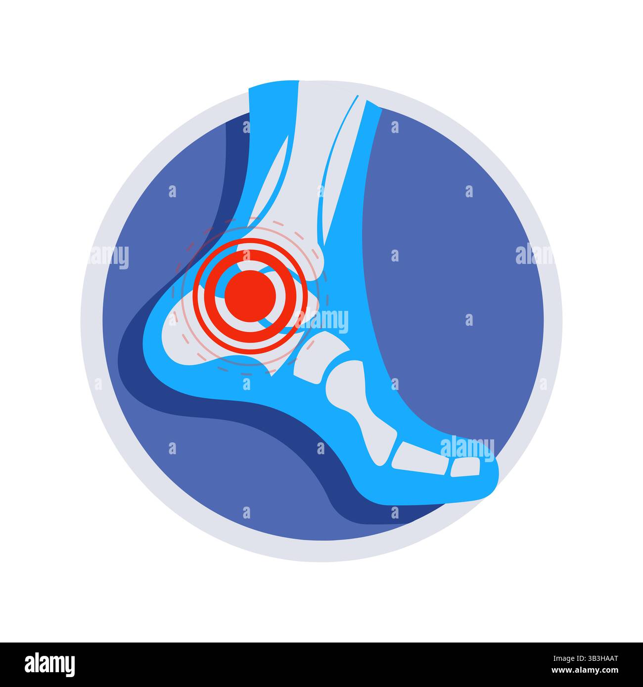 X ray showing ankle pain and inflammation inside a circle Stock Vector