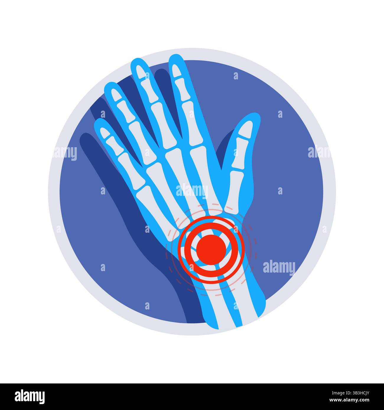 X ray of a hand showing wrist pain inside a circle Stock Vector