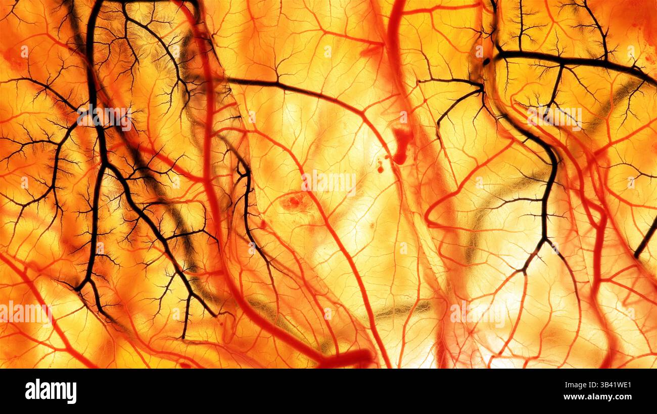 Light micrograph of diseased (black) blood vessels in a seven day old ...