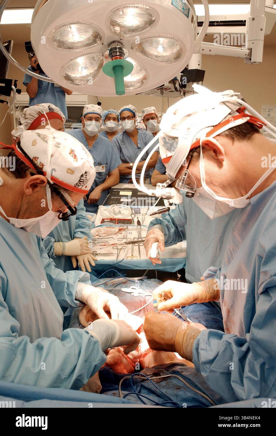Finat Procedures Conjoined twin separation hi-res stock photography and images - Alamy