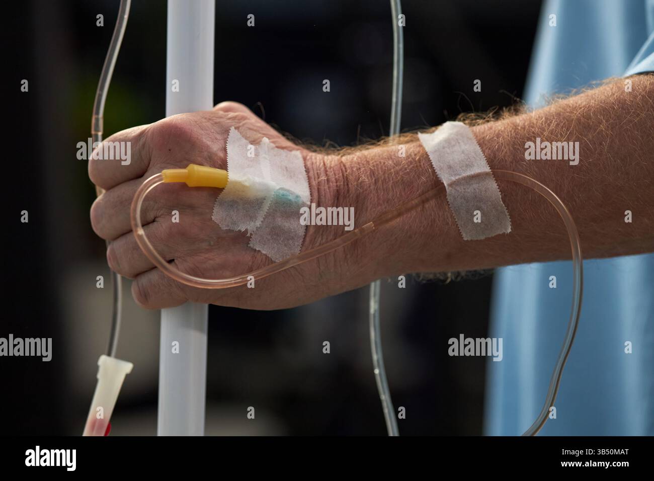 Hand Receiving Medical Treatment in Hospital Stock Photo - Alamy