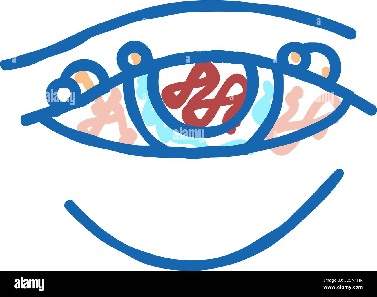 blepharitis disease, redness of eyeball icon doodle illustration Stock ...