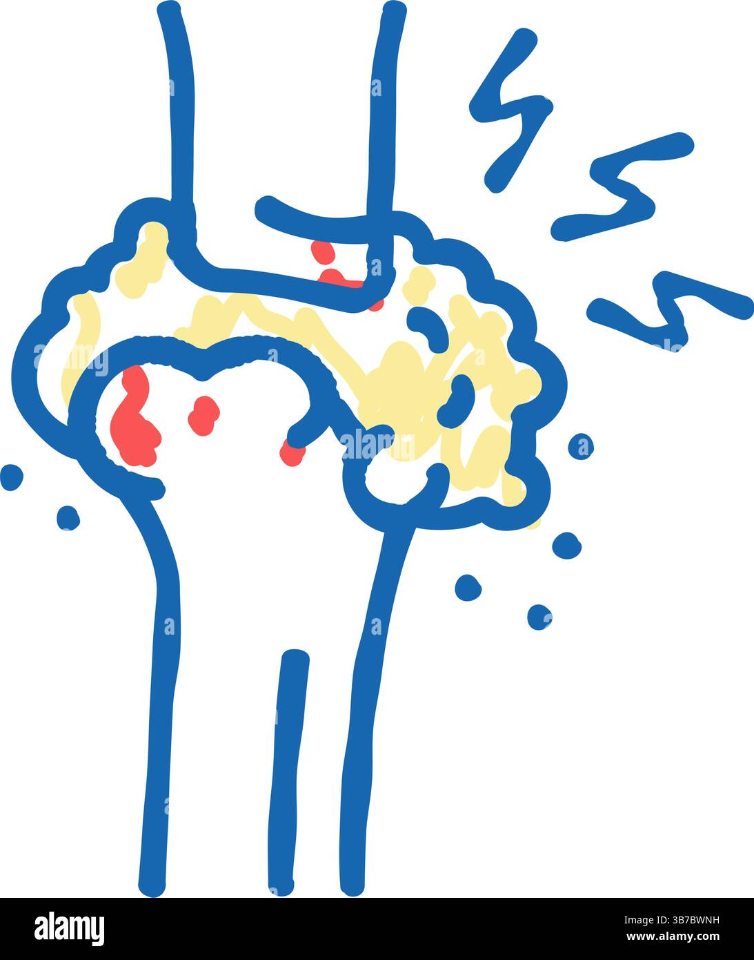 gout health problem icon doodle illustration Stock Vector Image & Art ...