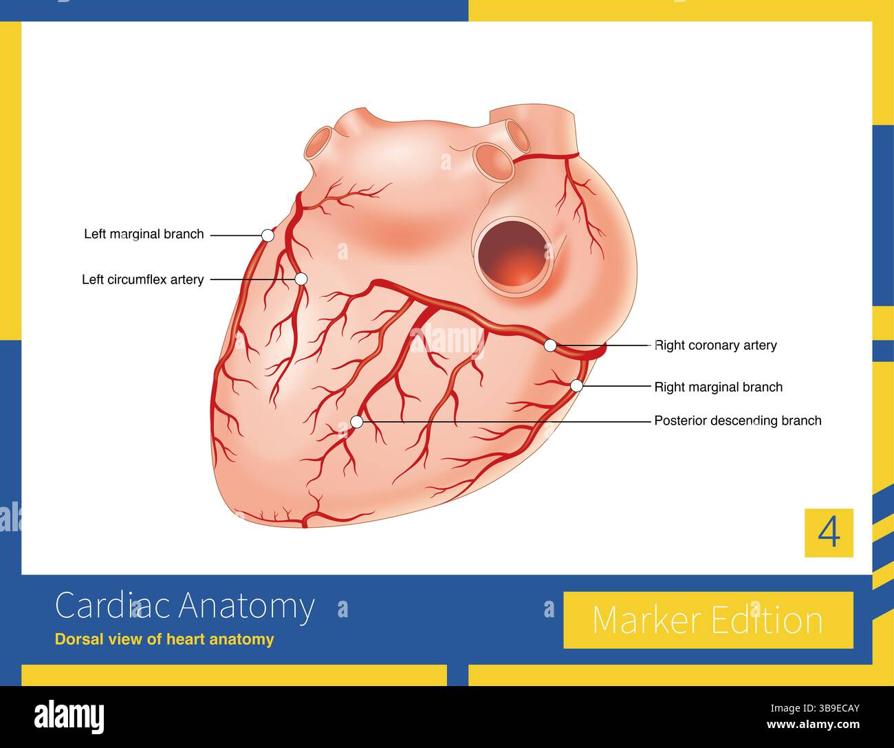 Most individuals have a dominant distribution of the right coronary artery, which sends out the posterior descending branch to supply the posterior in Stock Photo