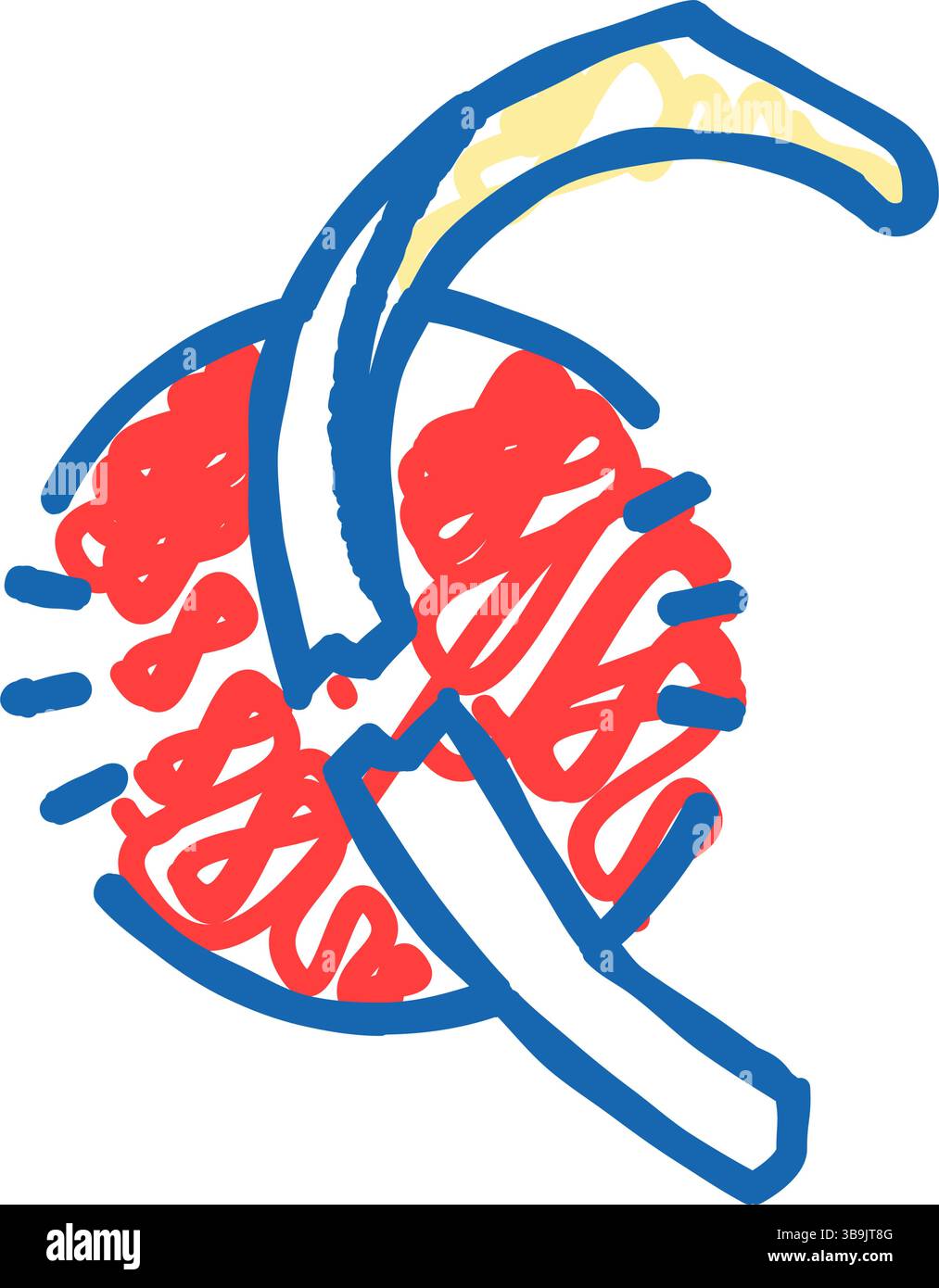 Fractured rib hi-res stock photography and images - Alamy