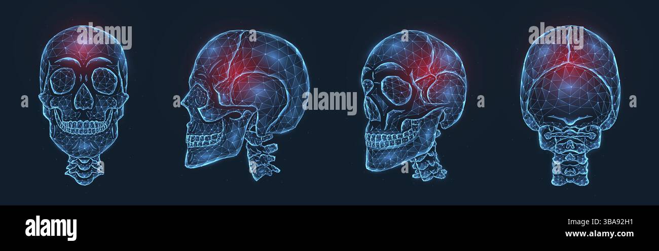 Skull Potential Injuries Pain, injury or inflammation of the skull bones polygonal vector ...
