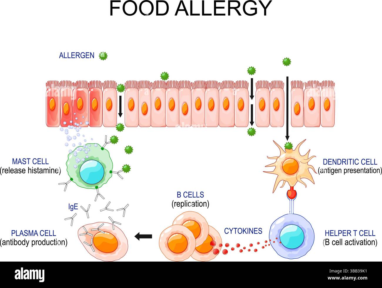 Food allergy. Process of allergic reaction and immune response. Vector illustration. Medical poster. Schematic diagram Stock Vector