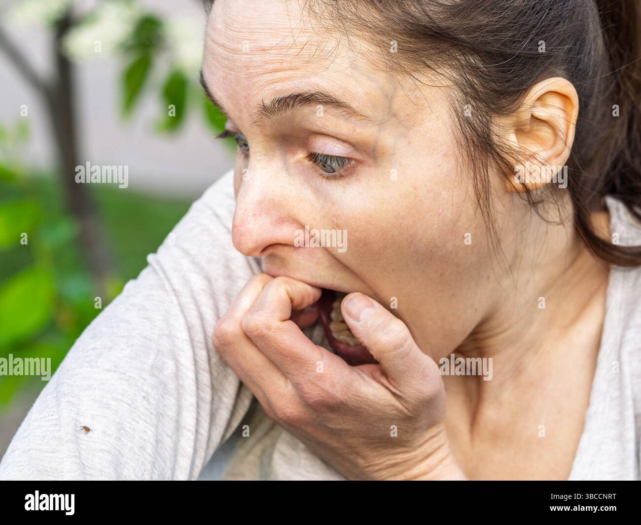 A closeup of a deer tick found crawling around on the arm of a person. The arachnid is a reddish color and has its legs stretched out as its crawling Stock Photo