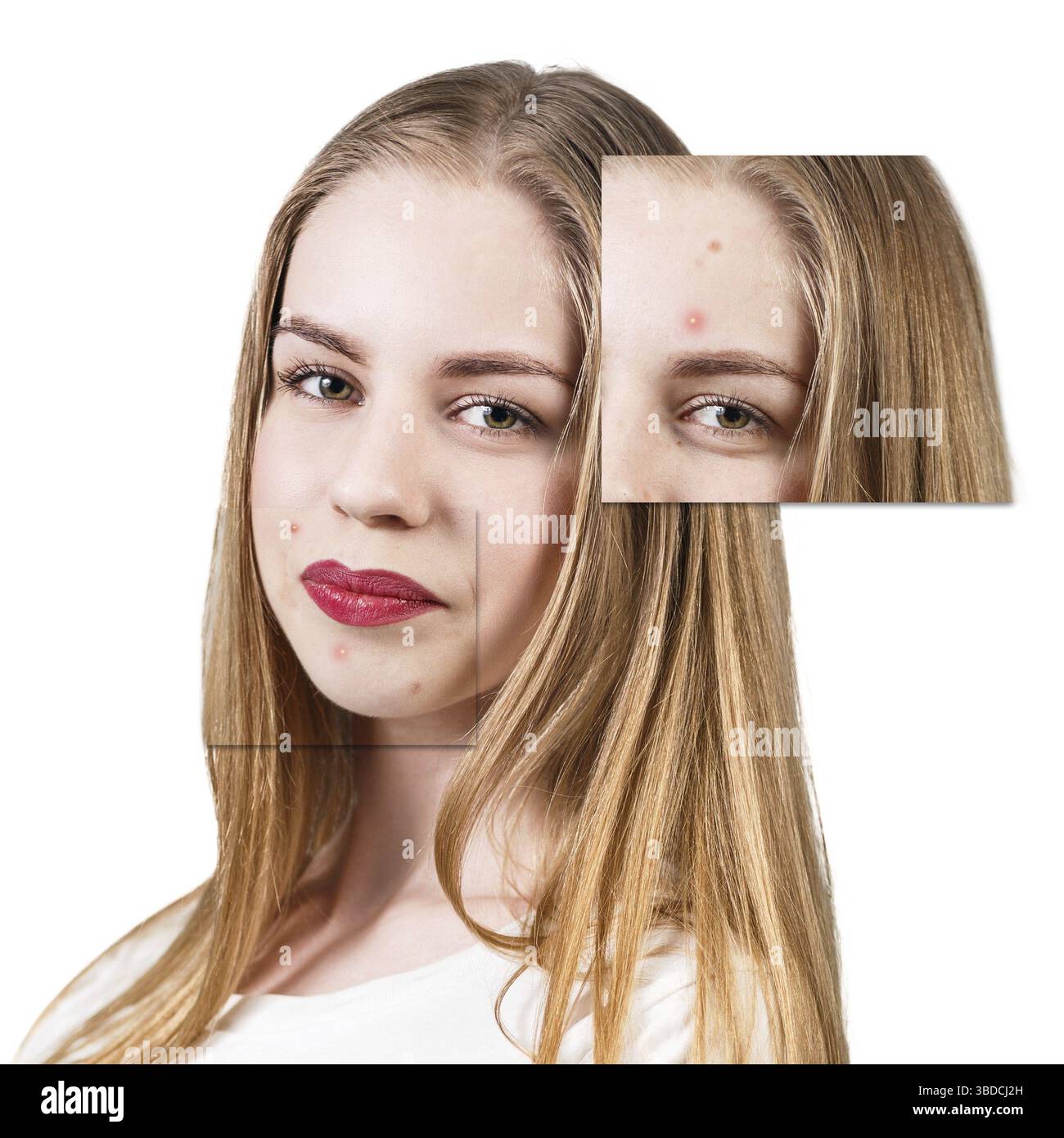 Face With Problem Frames with problem skin on beautiful woman face isolated on white ...