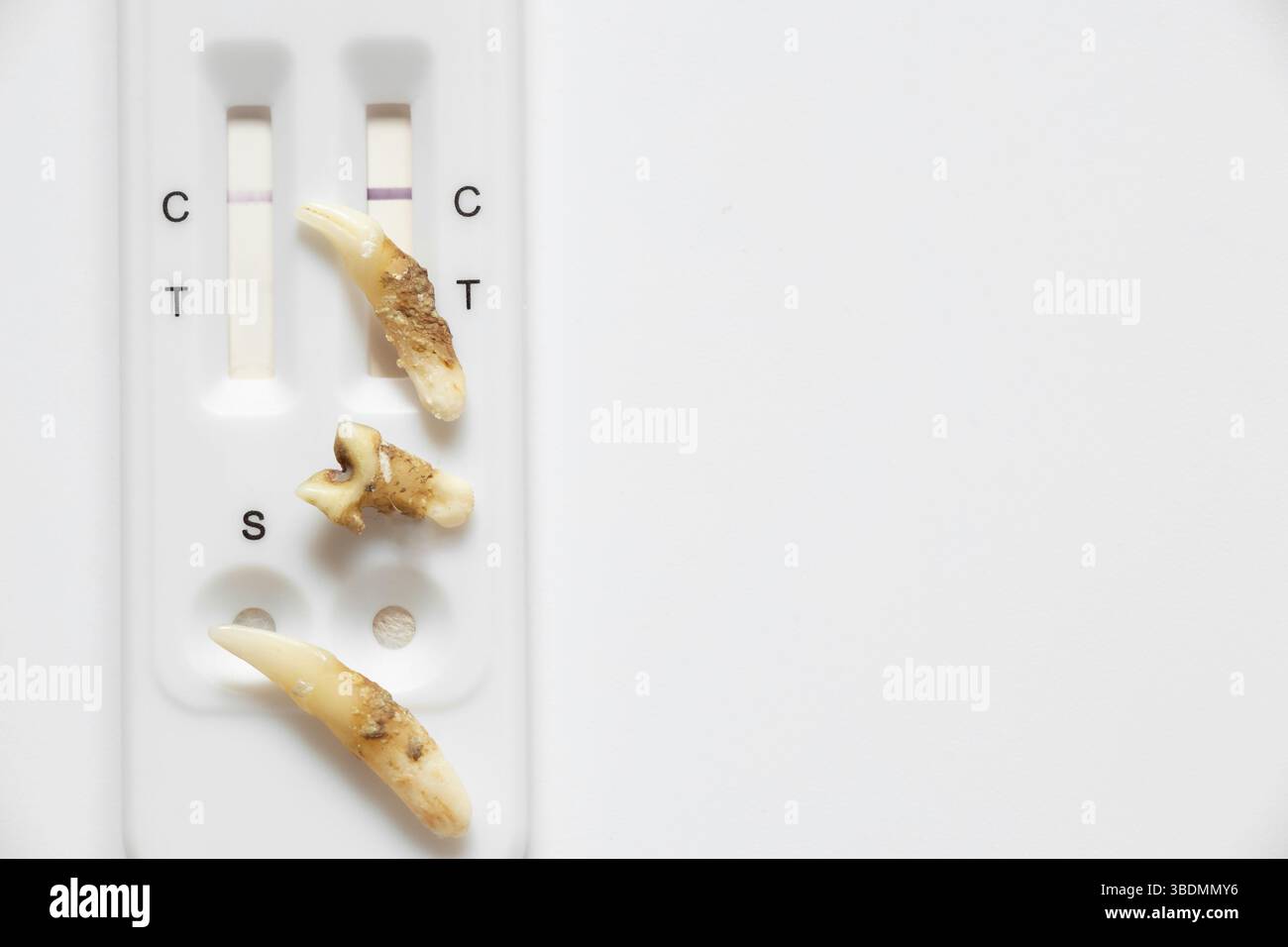 Cat Leukemia Dental Hygiene Reference: Cat Teeth With Plaque And Express Test For Viral Leukemia