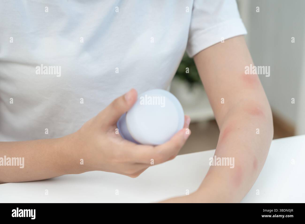 Skin and beauty problems Women have itchy skin and red rashes from ...