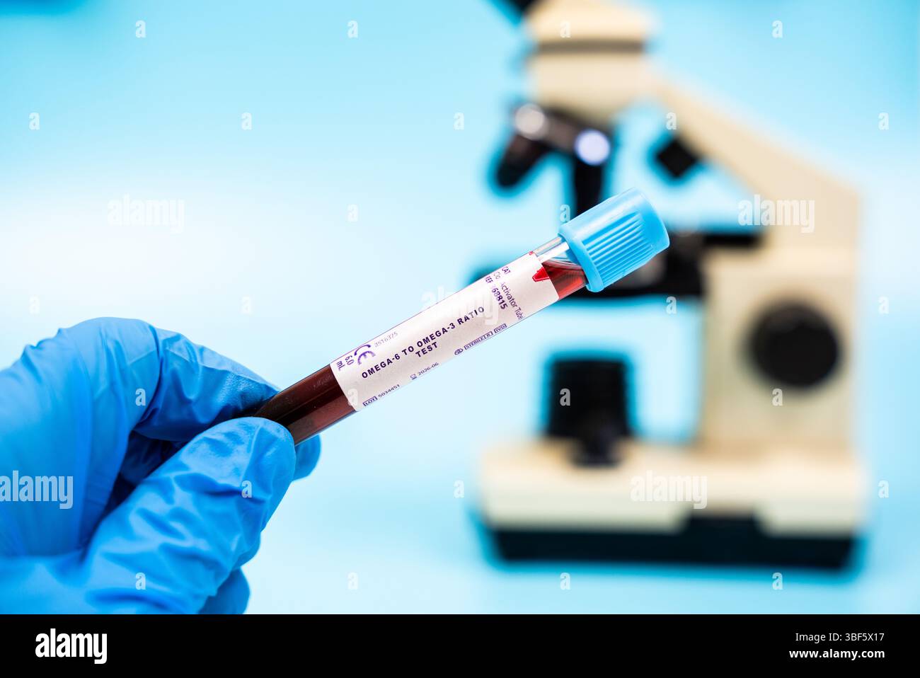 Omega-6 to omega-3 ratio test. Evaluates the ratio of omega-6 to omega-3 fatty acids, important for assessing inflammatory balance. Blood test in laboratory. Stock Photo