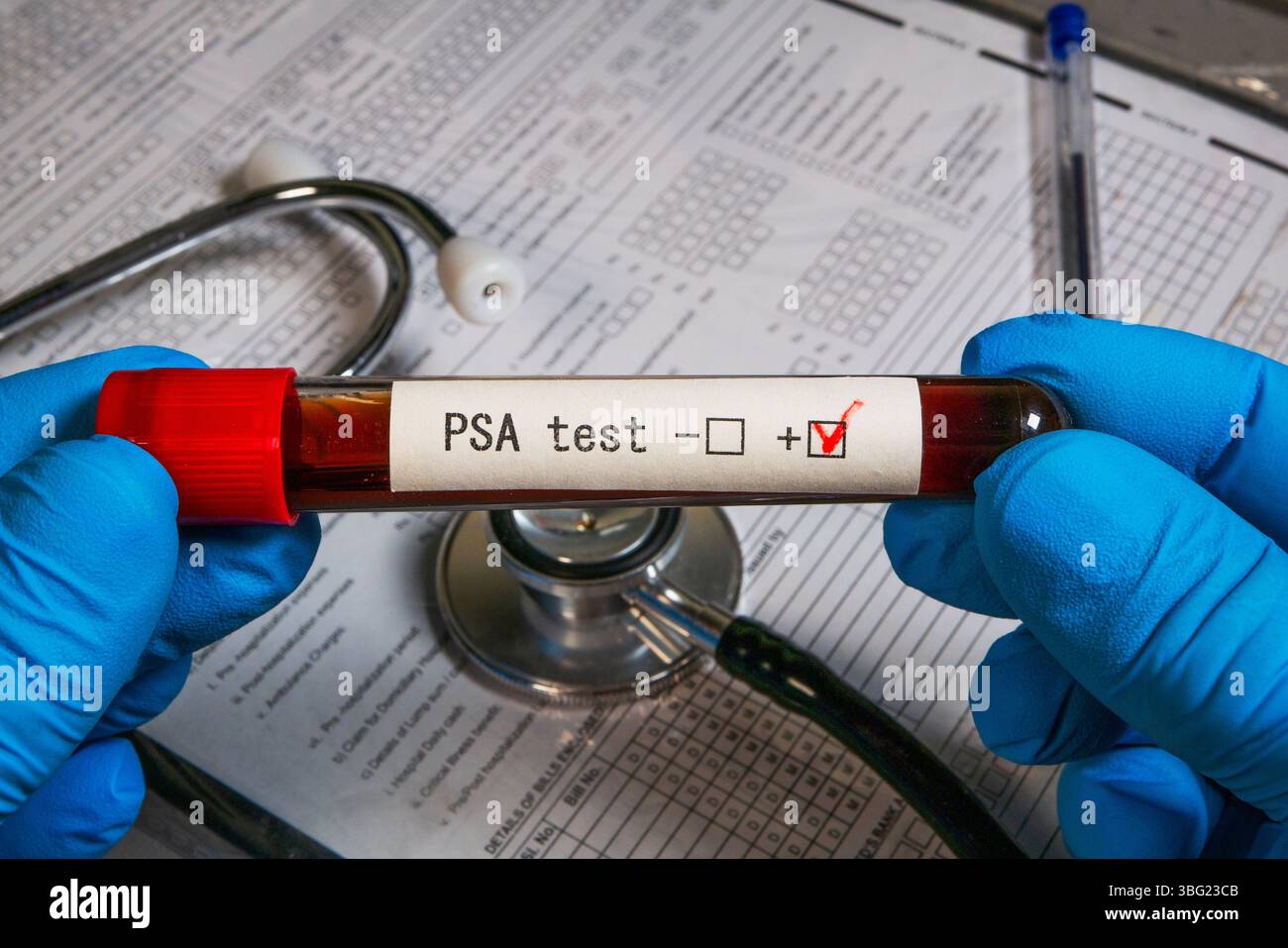 Doctor showing a positive psa test result with stethoscope on a medical ...