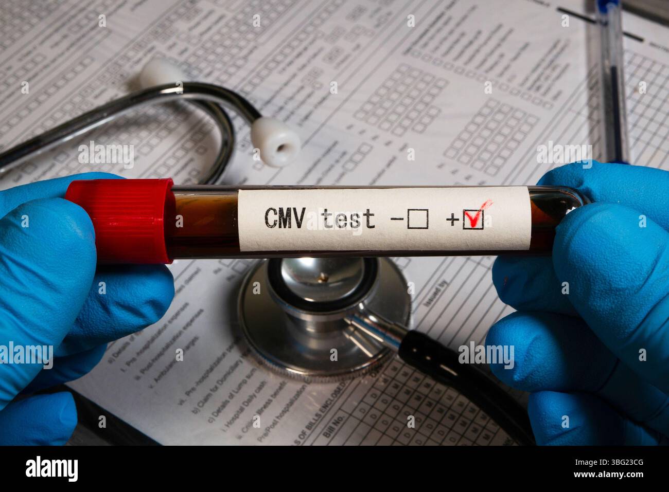 Gloved hands holding blood sample showing positive result for cmv test ...