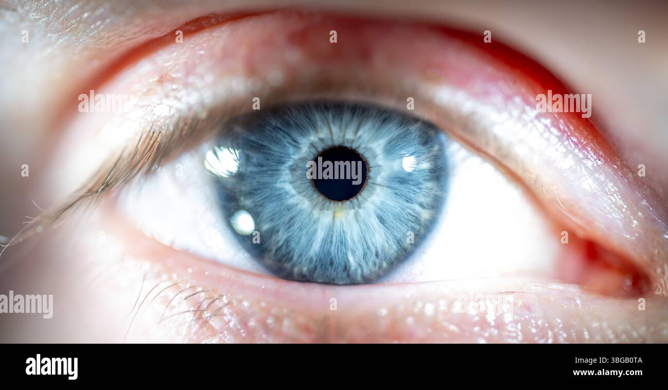 Description: Male eye with blue coloured closed iris. Structural and ...