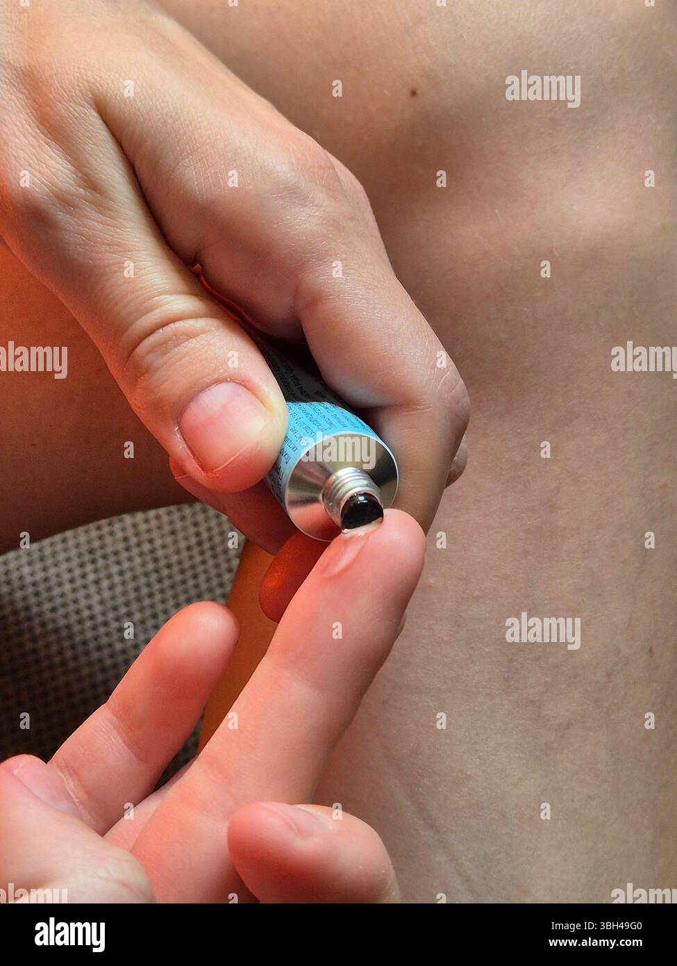 cream for spider veins on legs. woman applies cream to body. cream-gel on leg. tube of ointment in hands. problems with veins - Smartphone Captured Stock Image