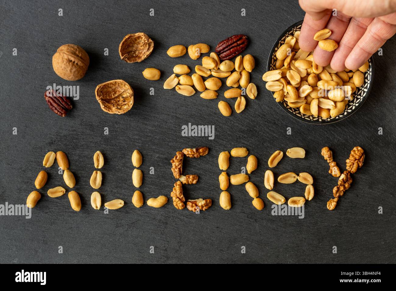 Nut allergy. The word ALLERGY is made up of various nuts. The concept ...