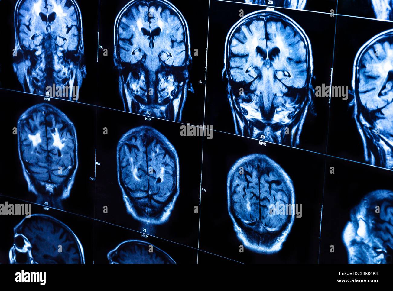 A group of CAT scans of the human brain closeup Stock Photo - Alamy