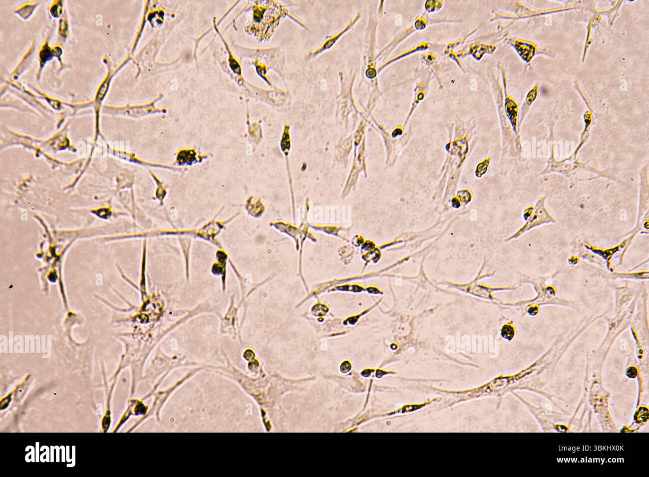 Glioblastoma cell culture. Human glioma cells under magnification Stock ...