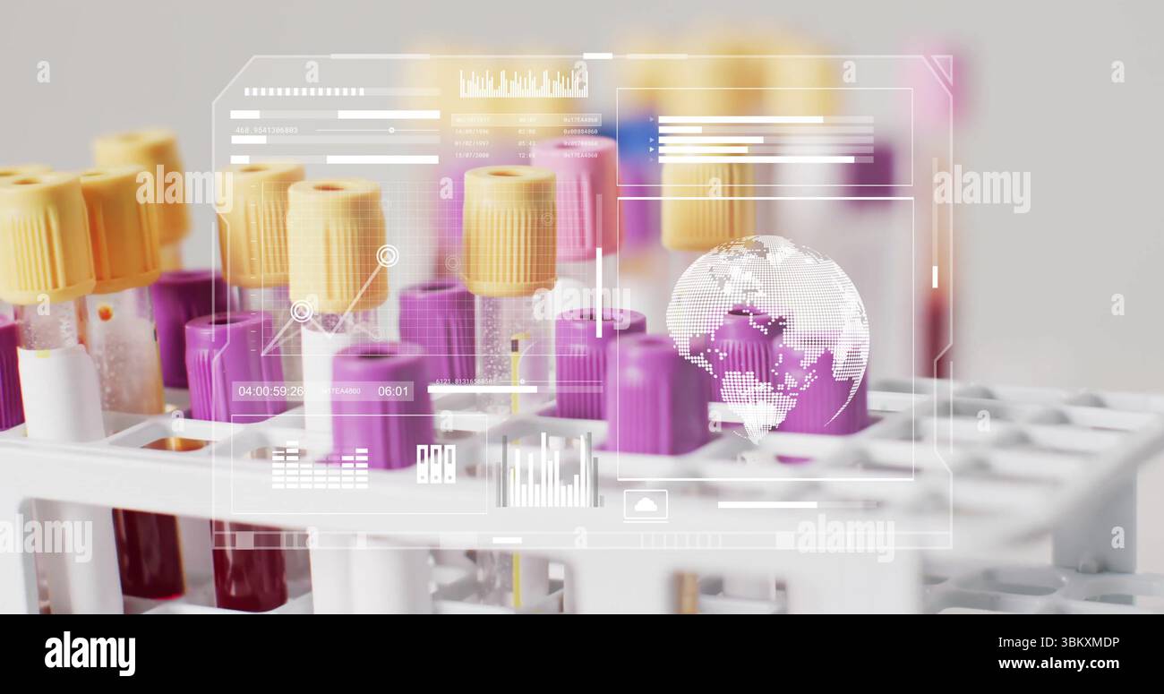 Displaying white plastic rack holding blood tubes with color-coded caps ...