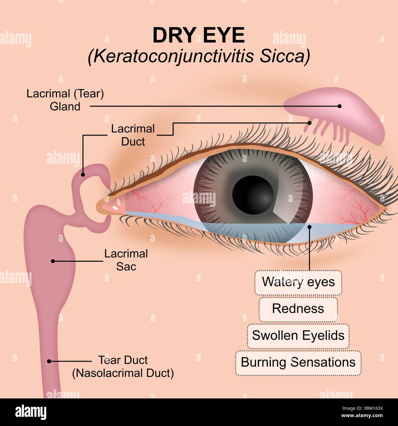 Dry Eyea keratoconjunctivitis sicca Stock Photo