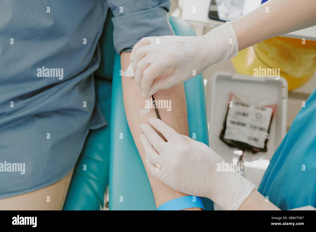 Receiving Draw Caucasian Young Adult Donor Receiving Blood Draw during Blood Donation ...