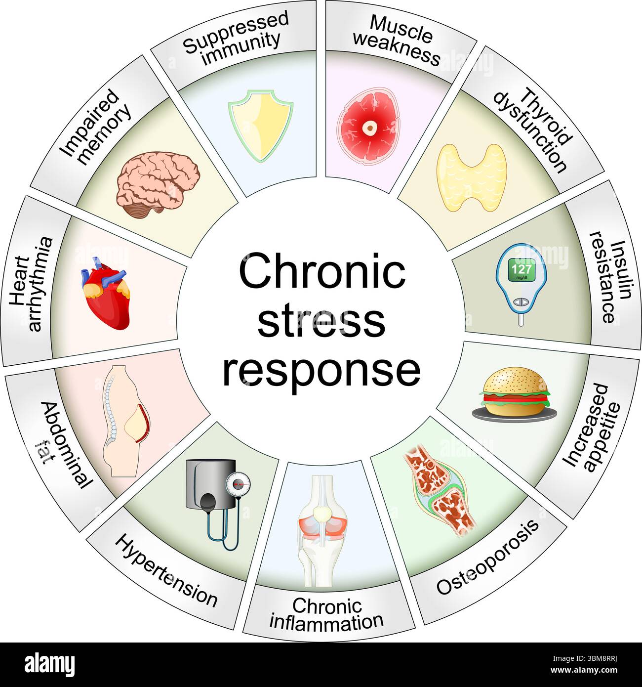Chronic stress response. Cortisol dysregulation. Long-term effects of stress hormones. Detailed Vector poster Stock Vector