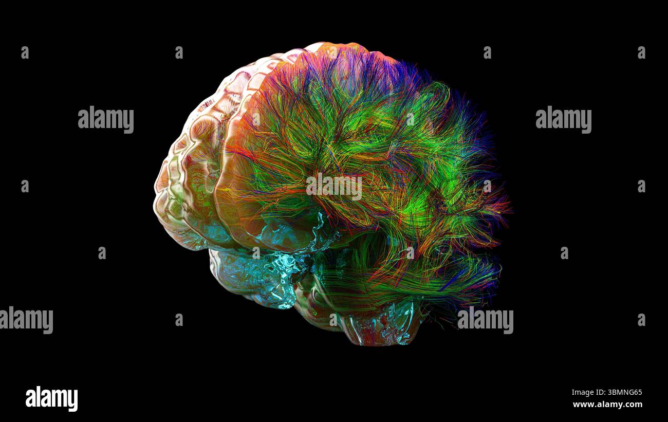 Illustration of a high-resolution brain tractogram, depicting the ...