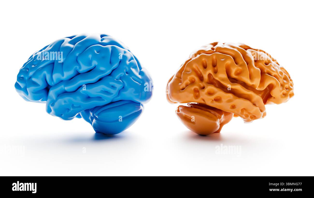 Illustration comparing a healthy brain (left) and one affected by ...