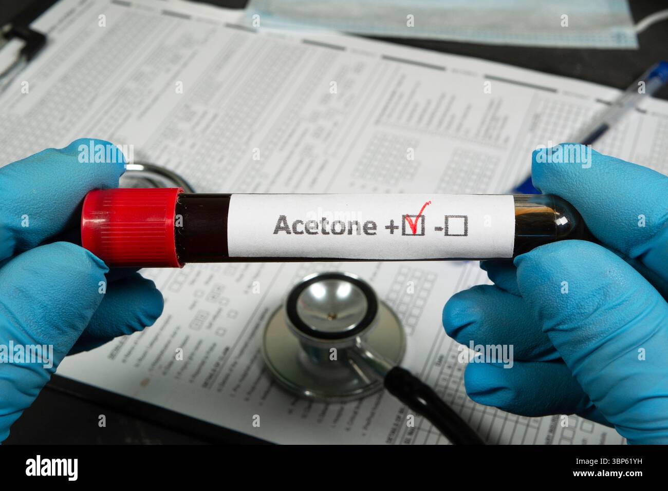 Acetone Lab Color Tube Doctor wearing blue gloves holding blood test tube indicating positive ...