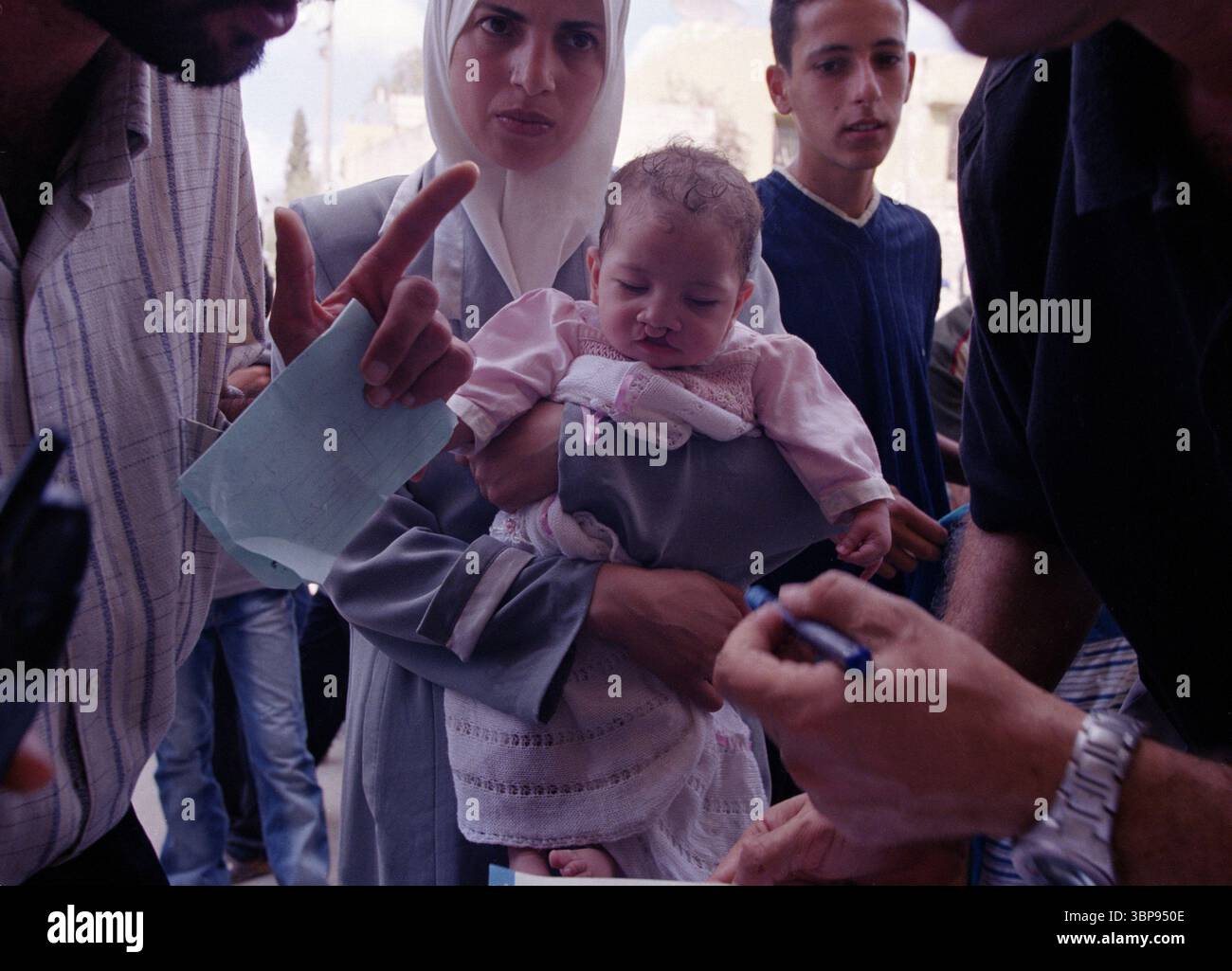 Baby with double cleft palate at PHR clinic Stock Photo - Alamy