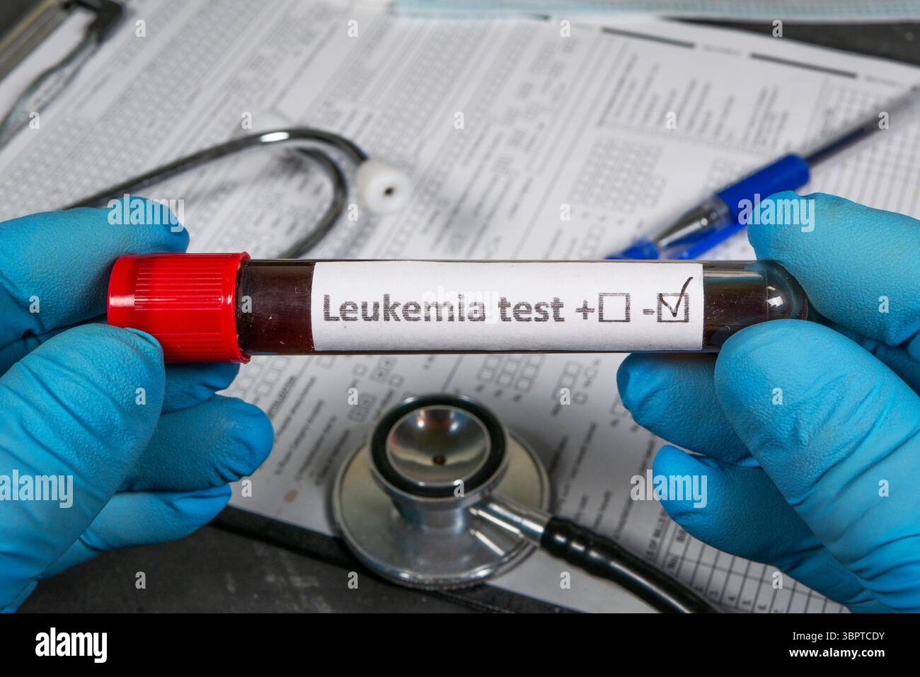 Image showcasing Gloved hands holding a test tube with blood sample for leukemia test ...