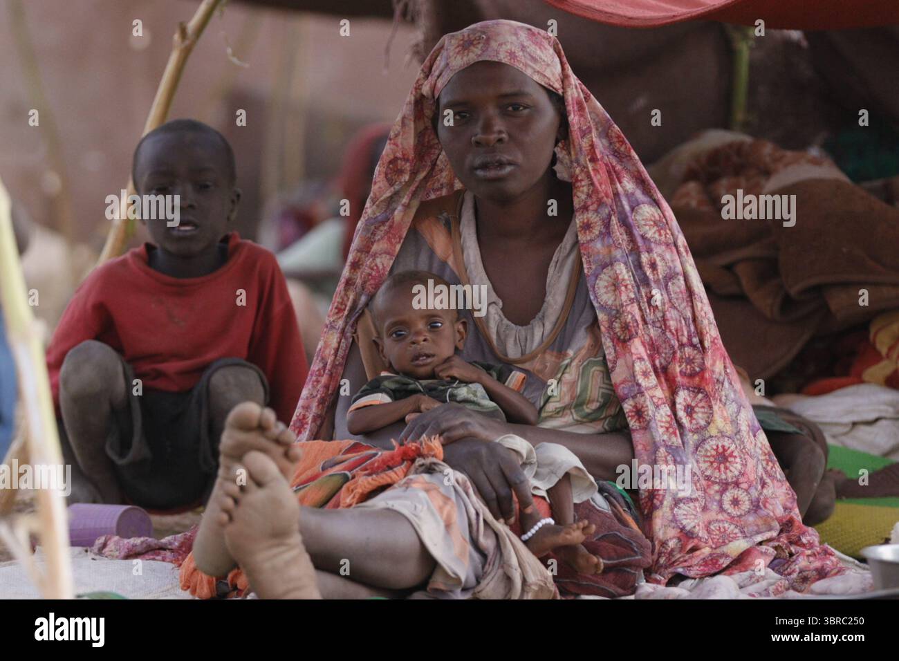 Acute malnutrition sudan hi-res stock photography and images - Alamy