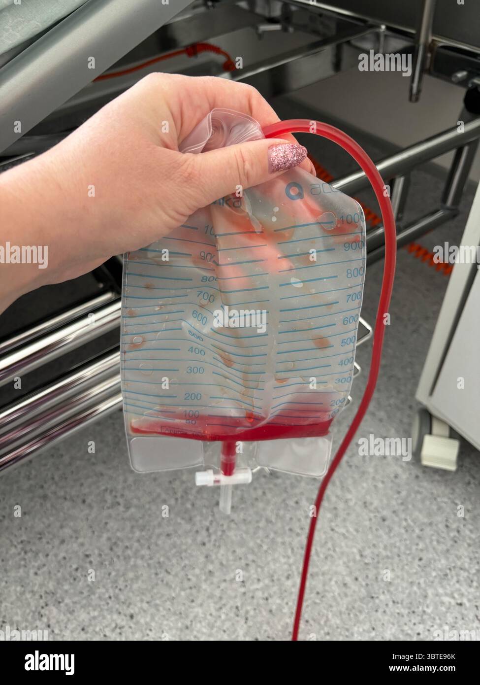 Hemovac hi-res stock photography and images - Alamy