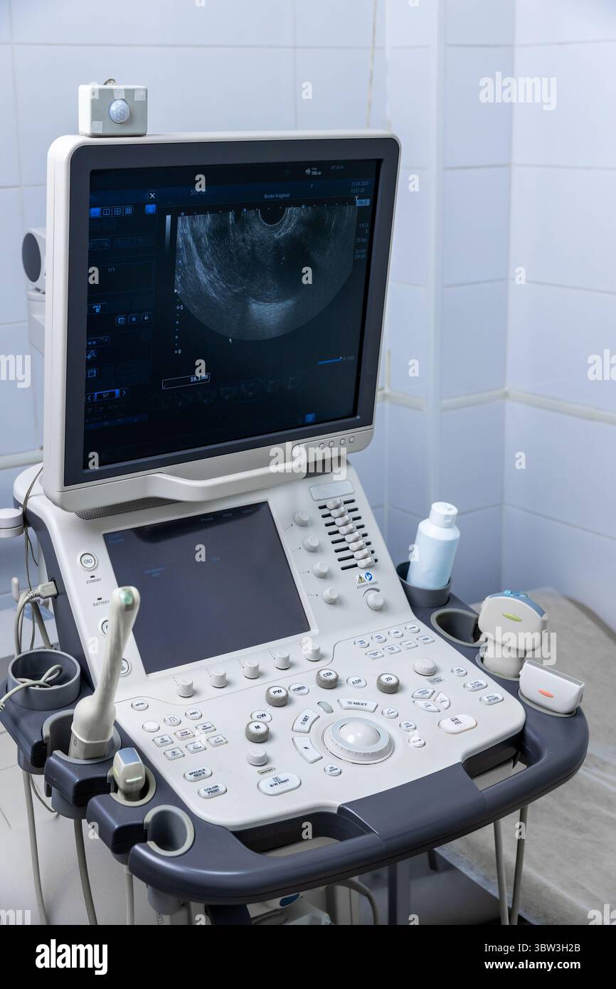 Advanced Ultrasound Machine with Control Panel and Monitor Displaying Diagnostic Image in Medical Examination Room Stock Photo