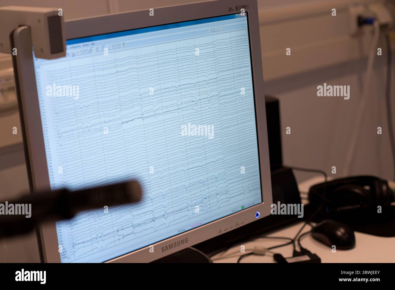 Eeg brain screen hi-res stock photography and images - Alamy