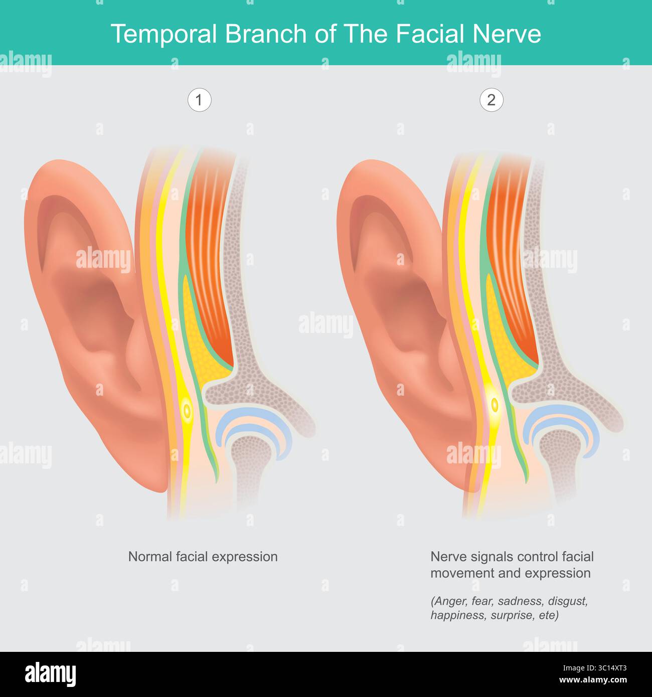 Temporal Branch of the Facial Nerve and Facial Expression Stock Vector ...