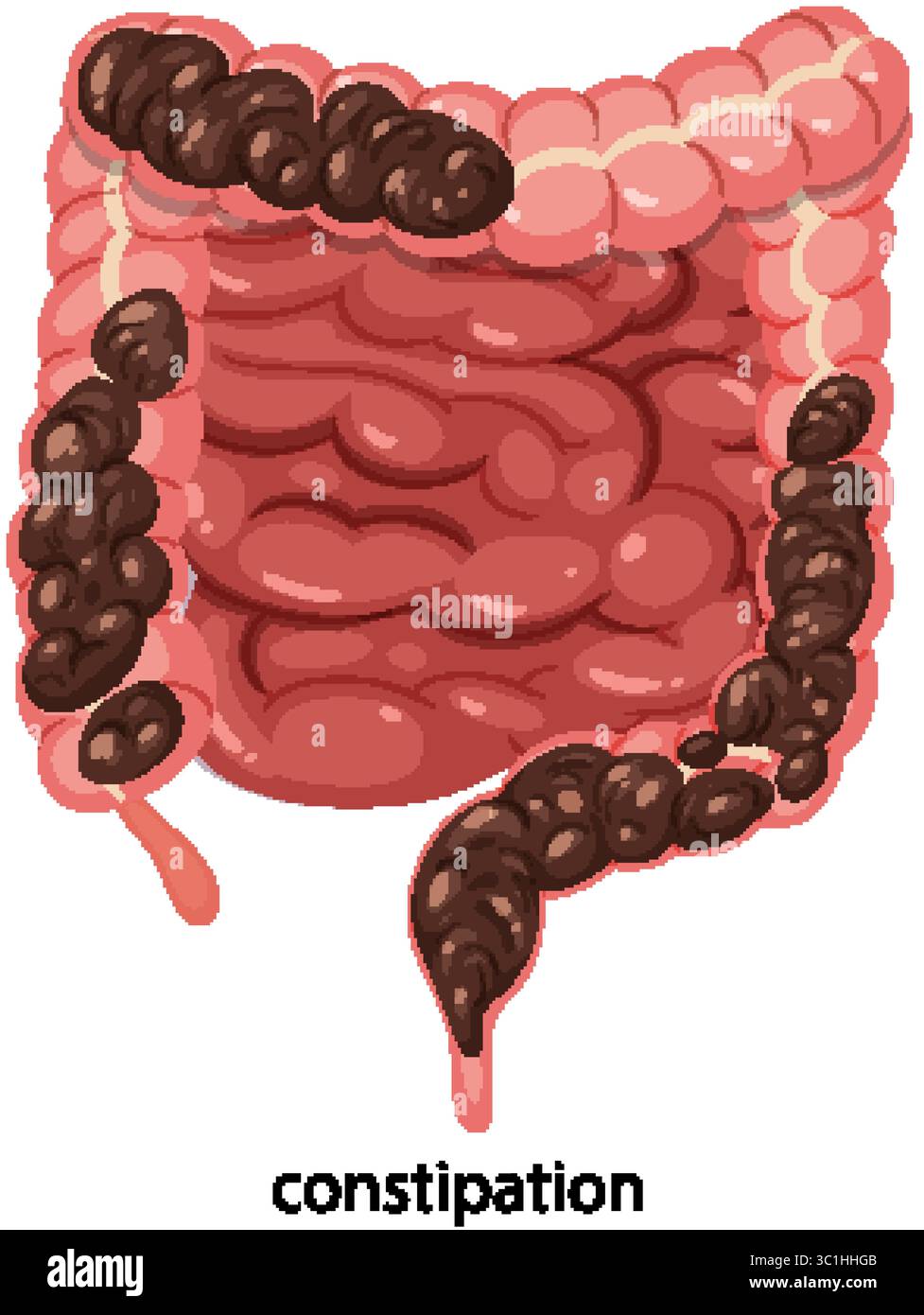 Detailed vector illustration of the human intestines highlighting ...