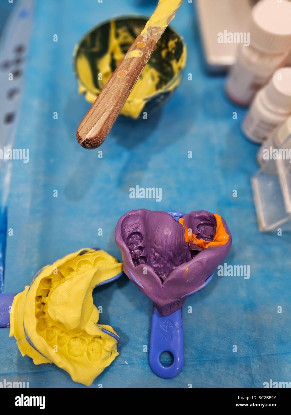 Impression Mold Dental Impression Materials and Molds on Blue Sterile Surface Stock ...
