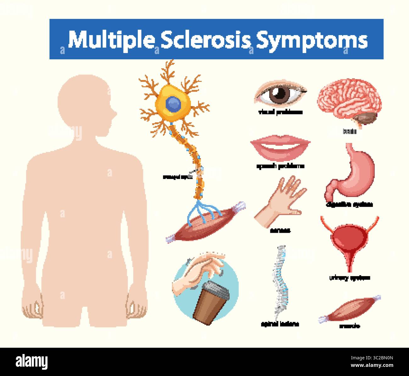 Educational vector diagram highlighting multiple sclerosis symptoms with labeled organs, nerves, and body systems in a clean, flat medical style Stock Vector