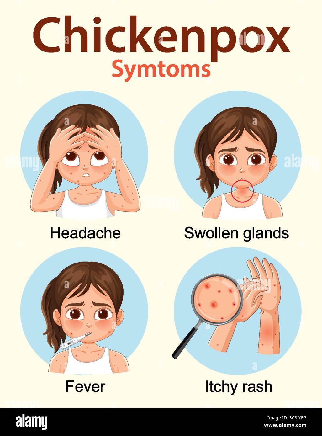 Vector illustration highlights chickenpox symptoms in children ...