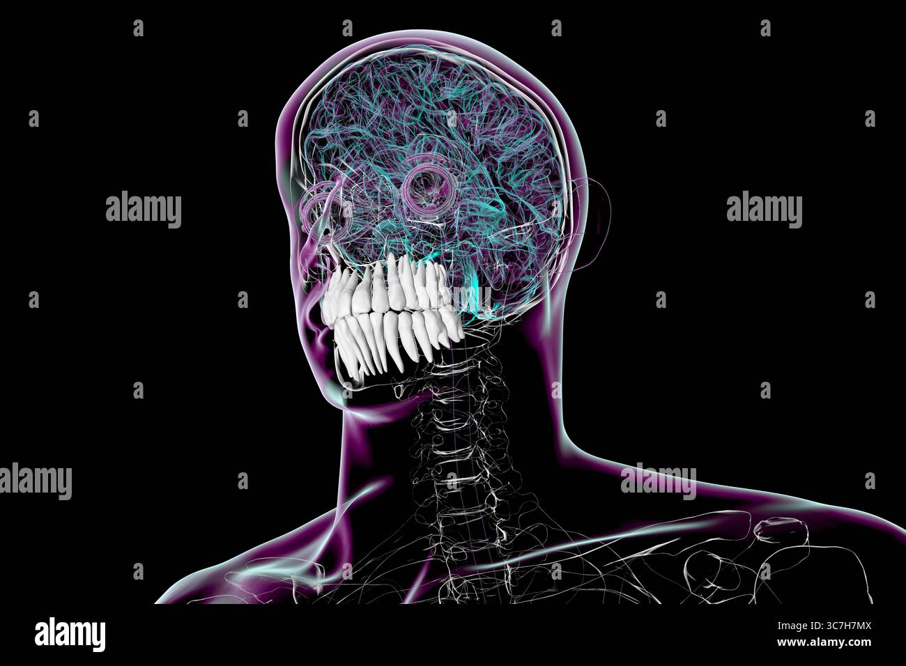 Human cervical spine and skull. 3D computed tomography (CT