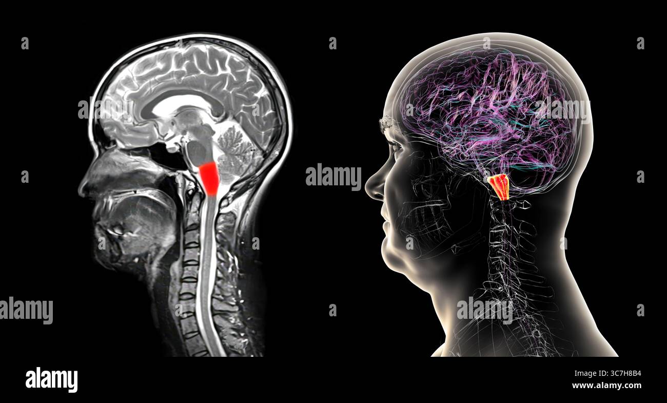 Coloured mri scan human body hi-res stock photography and images - Alamy