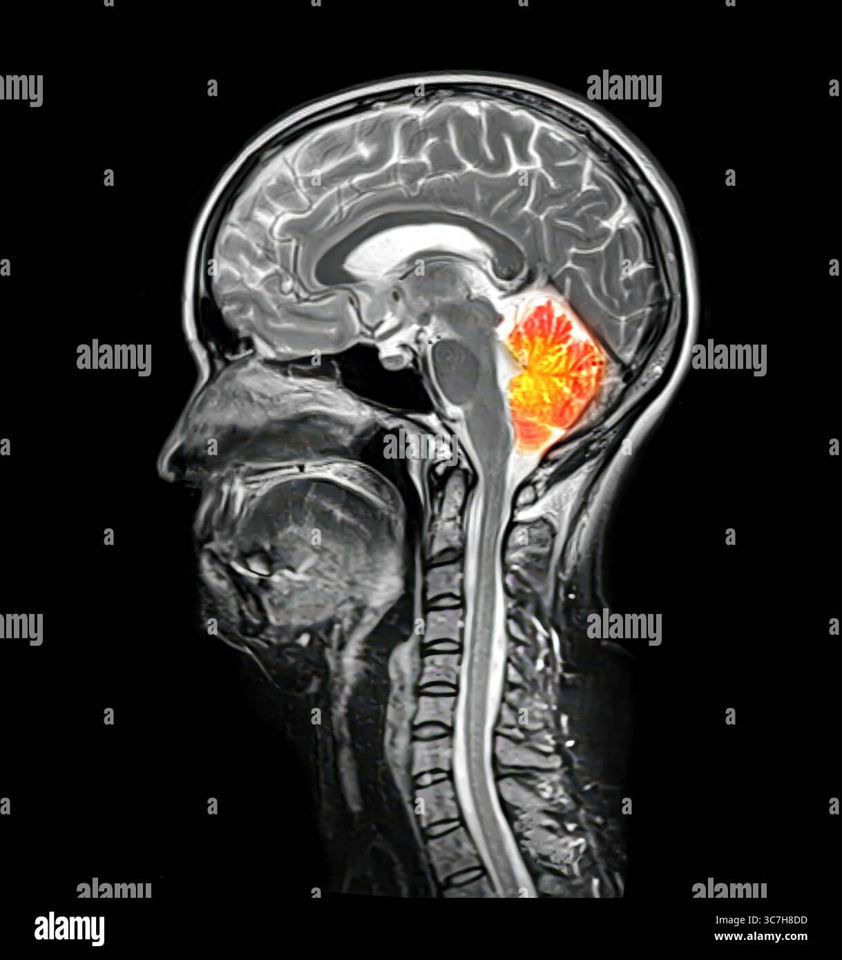 Illustrationmri hi-res stock photography and images - Alamy