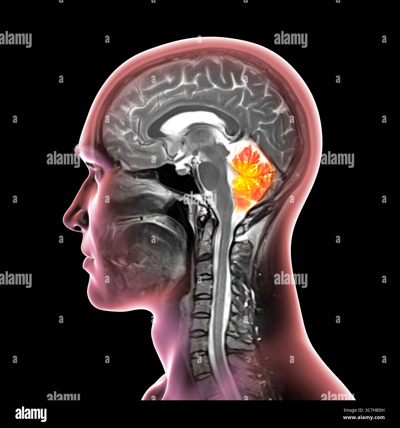 Illustrationmri hi-res stock photography and images - Alamy