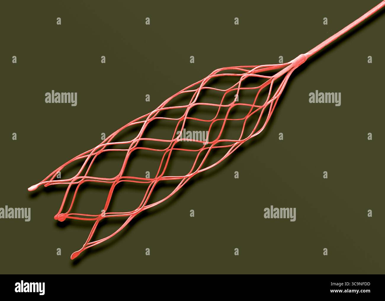 Coronary stent. Coloured scanning electron micrograph (SEM) of a ...