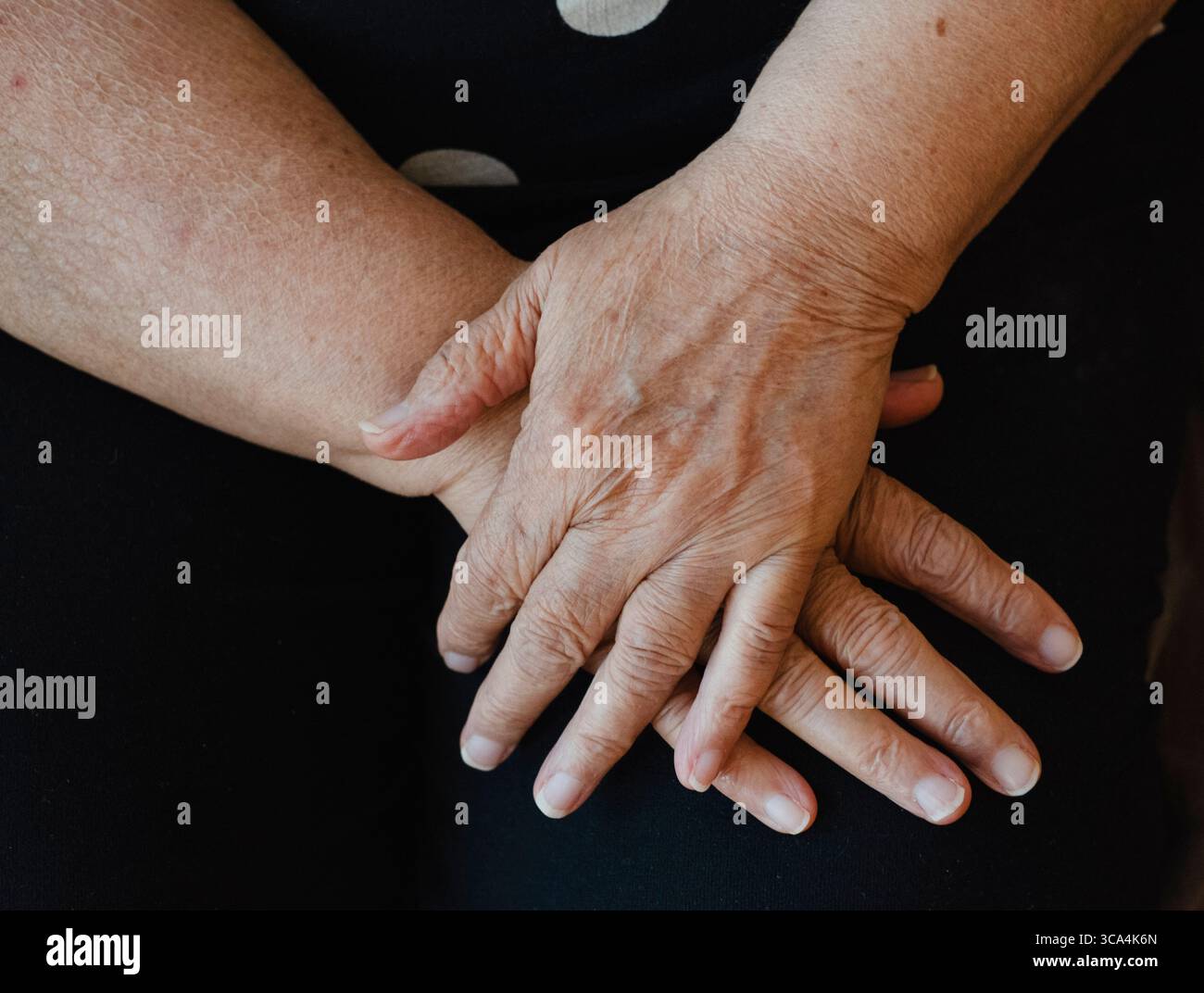 aging hands of a woman Stock Photo - Alamy