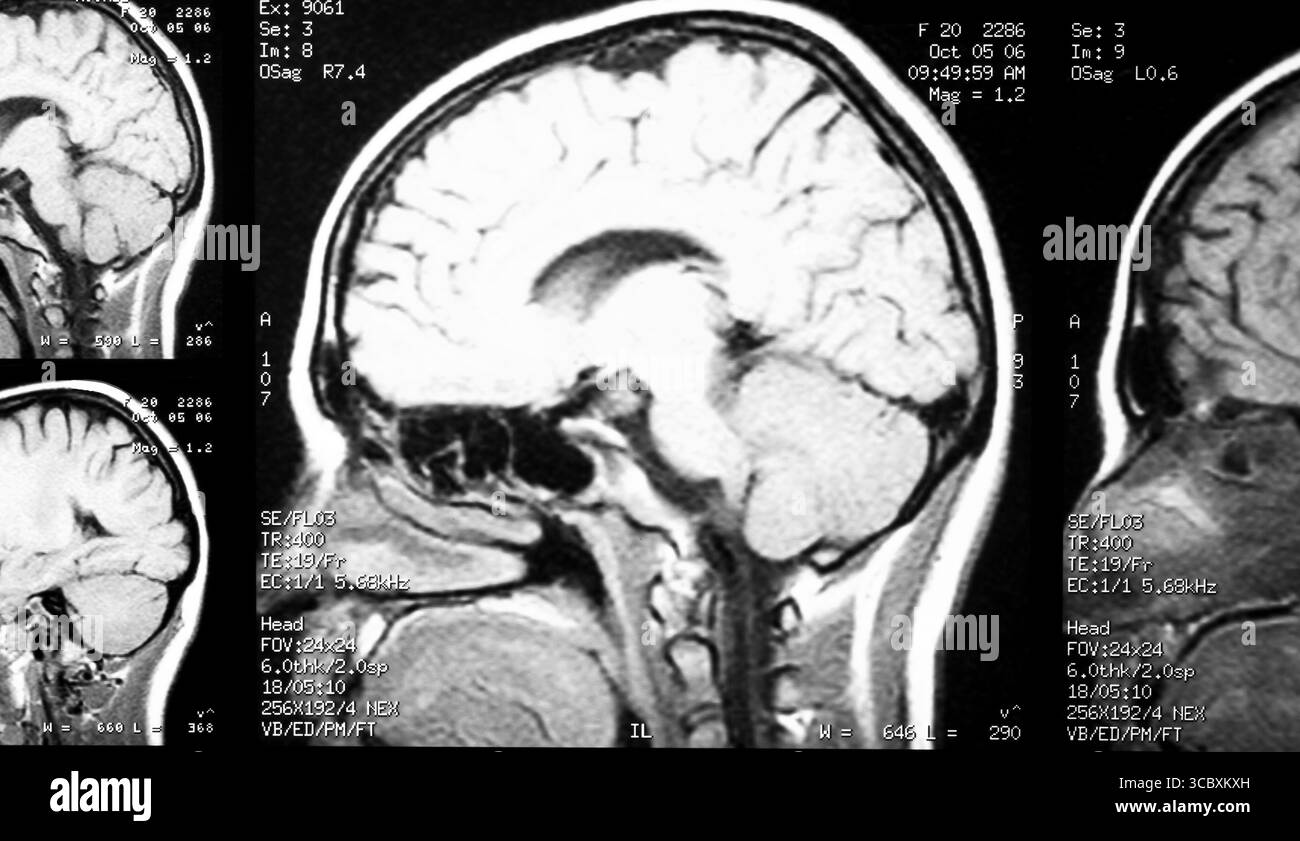 MRI Magnetic resonance image of the human brain and head. Medical ...